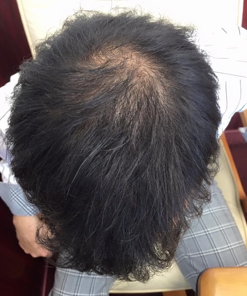 初回特価⭐︎育毛Only Oneアドバイスをします ＼先着30名様限定／自宅で育毛にコミット！最適なアドバイス イメージ2