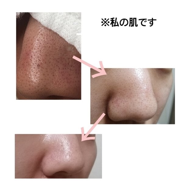 肌のお悩みに合わせたスキンケアを提案します あなたに合ったスキンケアを一緒に探しましょう◎ イメージ2