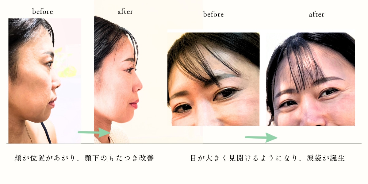 40代～3ヶ月表情筋レッスン｜10ポーズ習得します 月2回の個別レッスンで全10ポーズ習得！アーカイブ動画付き イメージ4