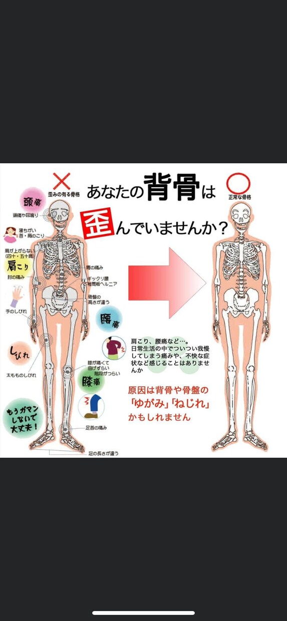 腰痛、肩こりなど症状改善の自己調整法を教えます 米国カイロ大学留学の知識と経験を元にアドバイス イメージ8