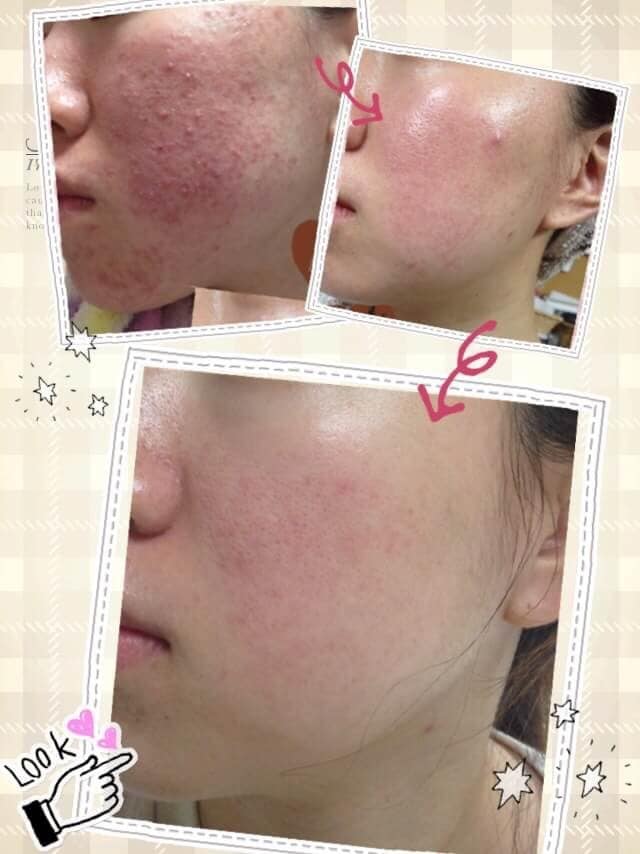 現役BAがあなたの理想のキレイなお肌に導きます 性別問わずどなたでも大歓迎です(^^) イメージ2