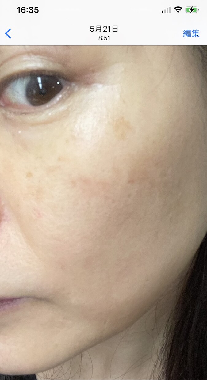 細胞を元気にするアドバイスをします 薄毛改善、アンチエイジング、健康寿命を延ばしたい方に。 イメージ3