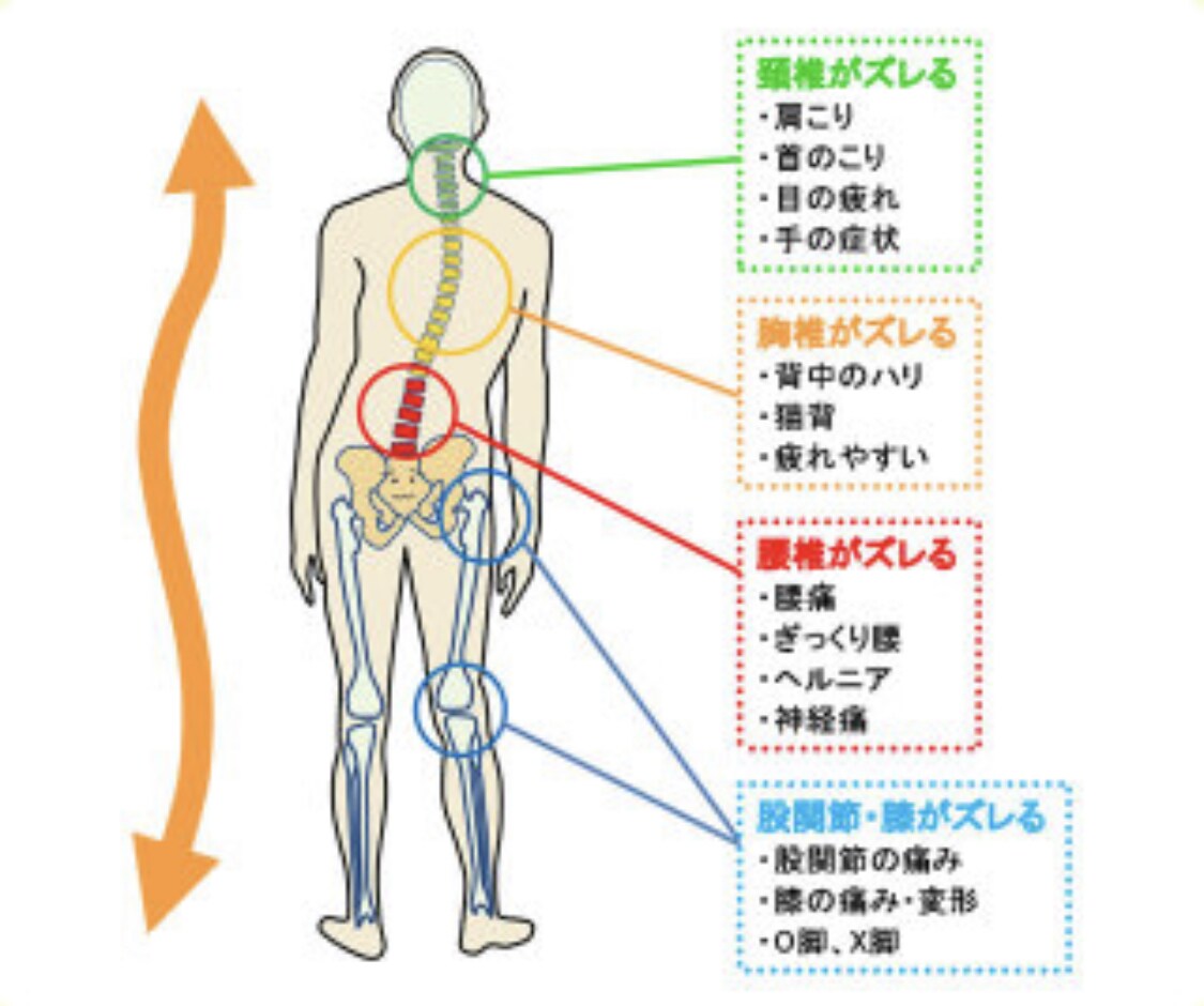 営業や接客の方必見！姿勢改善で第一印象を良くします 腰痛でお困りの方に骨盤矯正行ってきたプロ鍼灸師が教えます。 イメージ2
