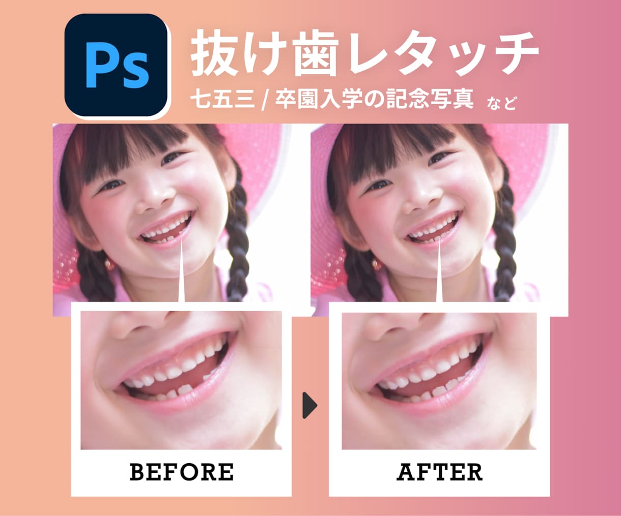 2枚1000円【七五三】歯抜け部分を加工いたします 七五三の記念写真で歯が抜けている部分を修正いたします！ イメージ3