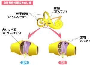 めまいで悩んでいる方改善方法教えます めまいで毎日憂鬱なあなたに必見！体感してめまいの発生ゼロ イメージ1