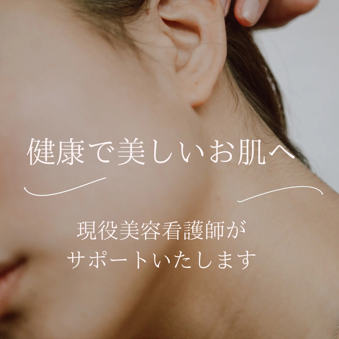 美容医療の知識で美肌のアドバイスを行います 現役美容クリニック看護師によるお肌のお悩み相談承ります イメージ1