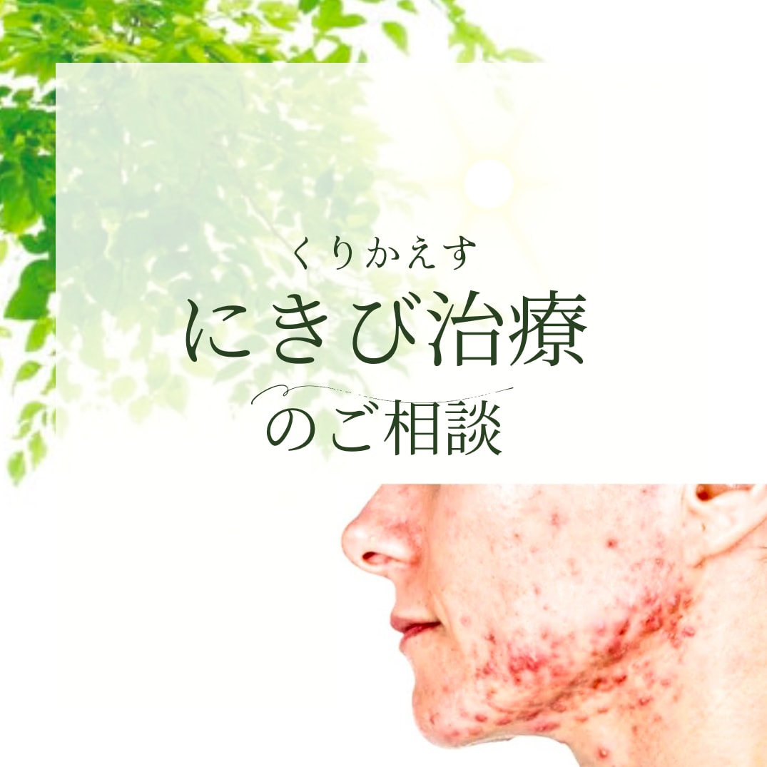 繰り返すにきびの治療スキンケア相談のります 毎回繰り返す、なかなか治癒しないにきびのお悩みありませんか？ イメージ1