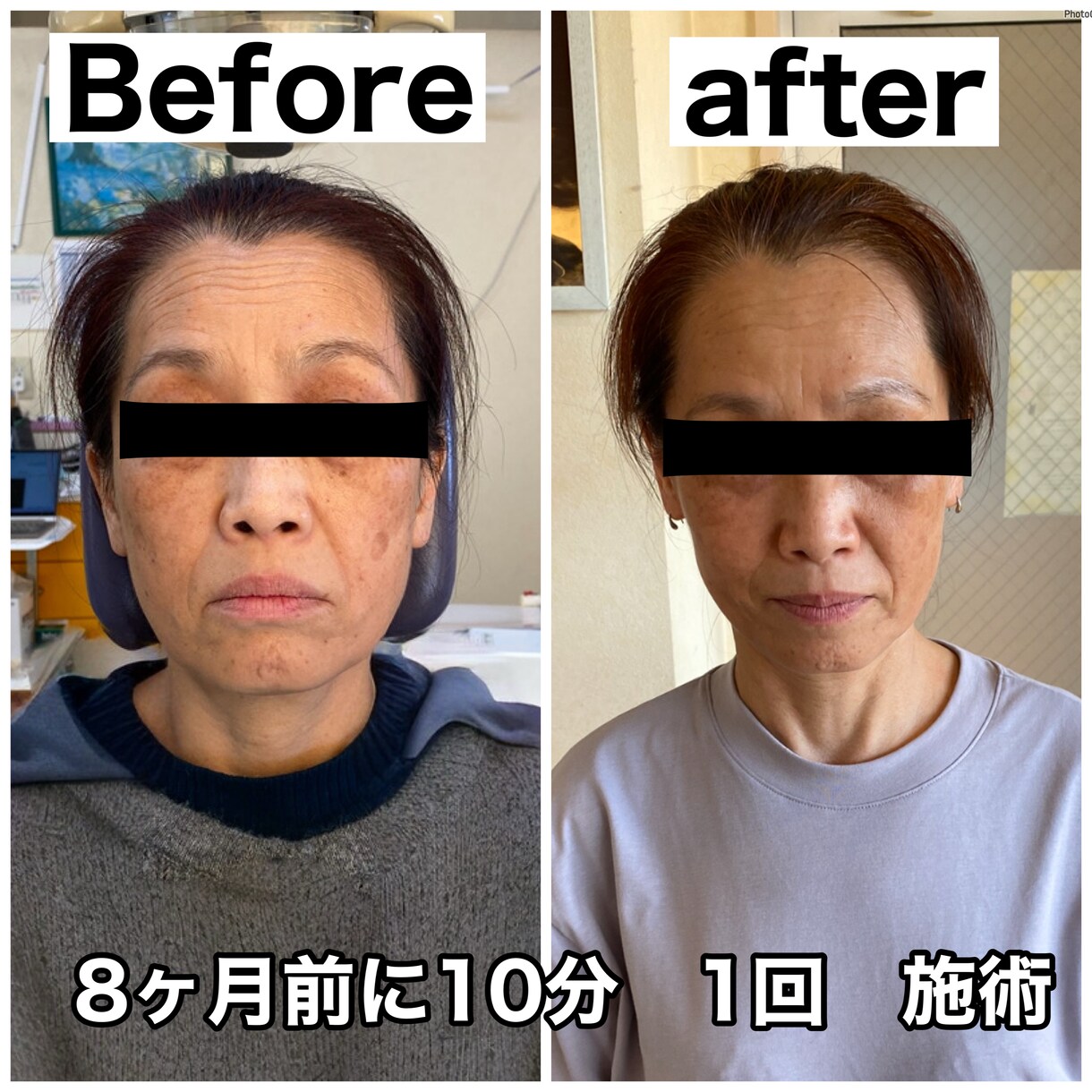 治らない悩み…歯科難民を根本から救います 機能だけでなく整形級の美しさ、小顔を求める方にもアドバイス！ イメージ2