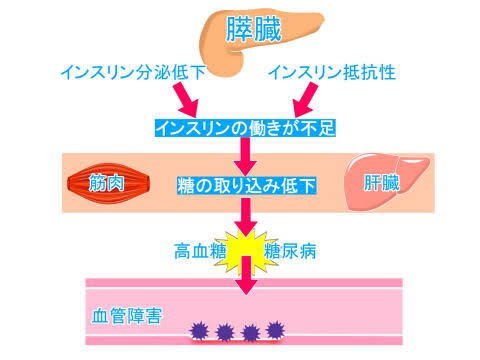 糖尿病療養指導士レポート課題添削致します 課題にはポイントがあります。これを受ければ抑えられます。 イメージ3