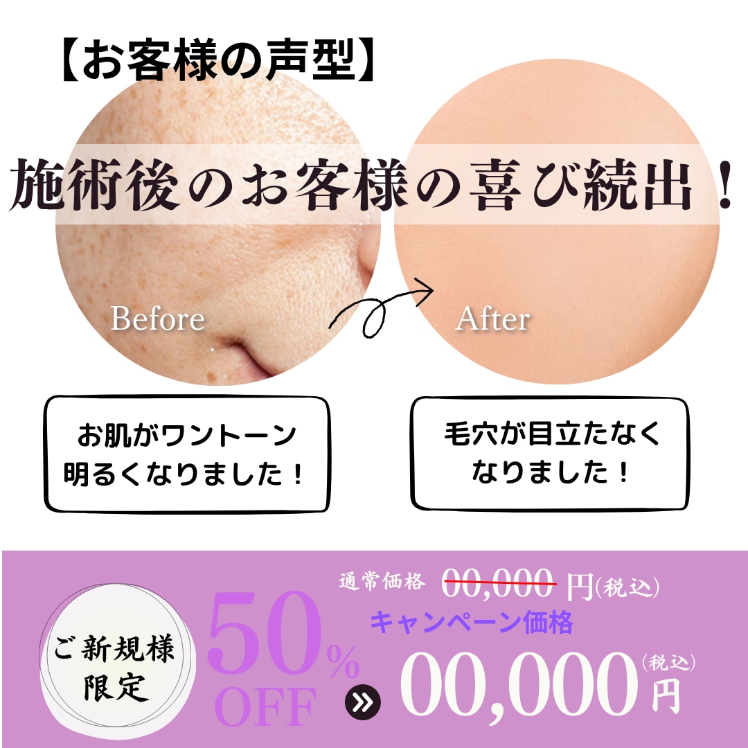 美容サロン販促バナー 美肌テンプレ3種ます Canva編集OK！初心者もすぐ使えます イメージ4