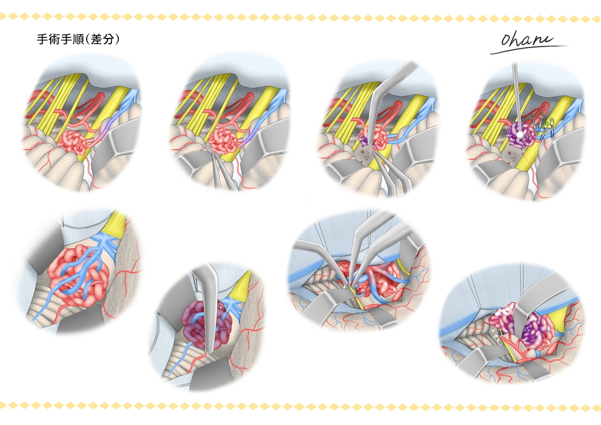 論文、書籍で使用するメディカルイラスト制作します 脳専門。2000枚以上制作しました。 イメージ5
