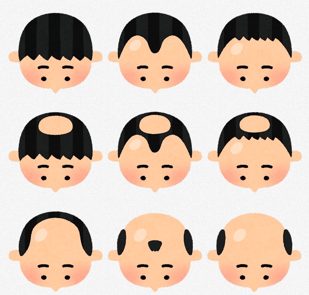 ハゲ•薄毛に効くおすすめの方法を教えます 安く、継続できる薄毛対策を教えます。 イメージ1