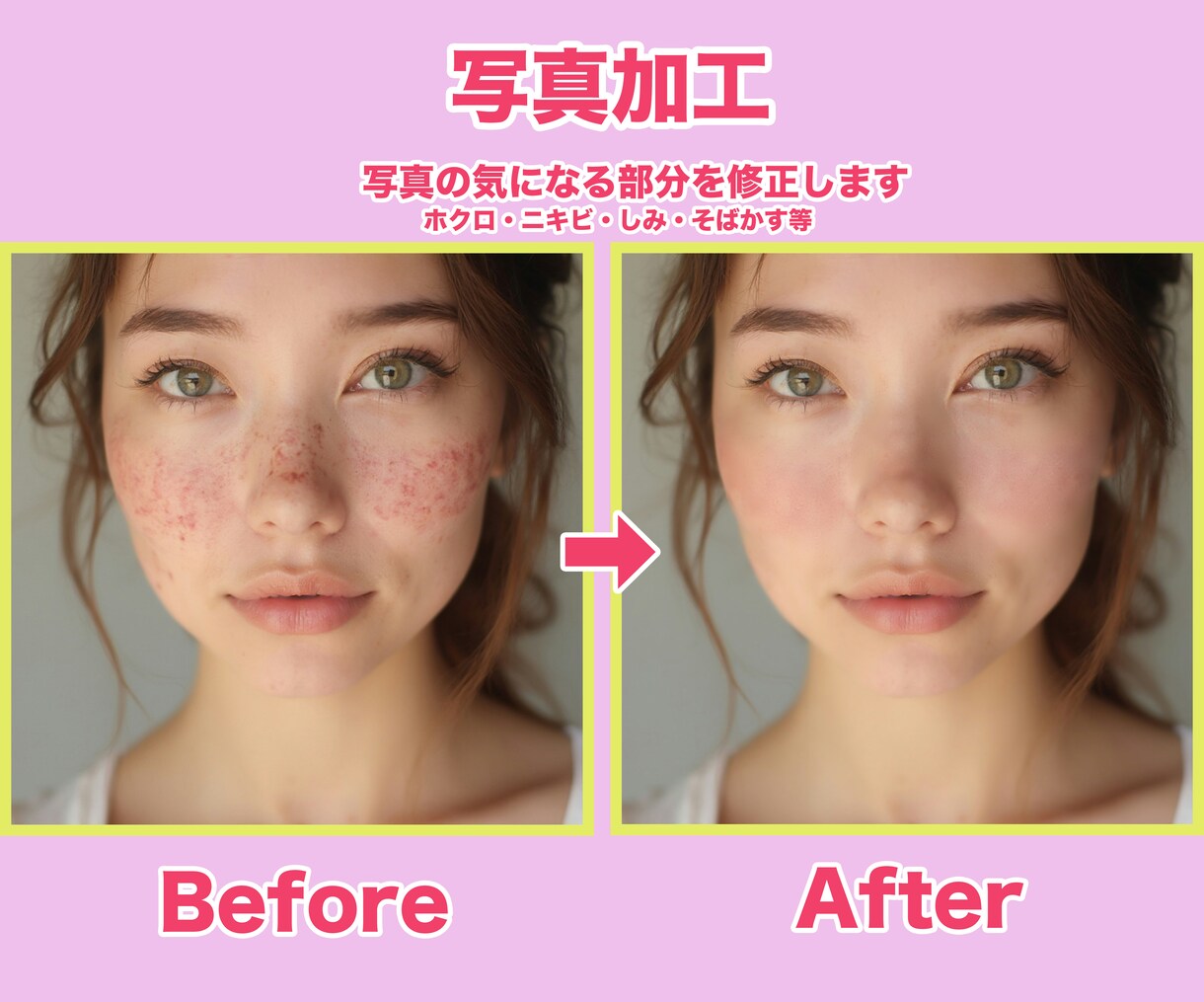 お写真の気になるところを加工します 大切な日のお写真を見て落ち込んでしまう方へ イメージ1