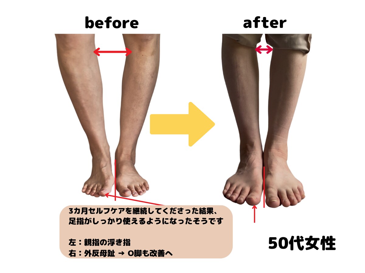 足指セルフチェック法をアドバイスします 【顔出し不要で気軽に相談、チェック～セルフケアまで教えます】 イメージ6