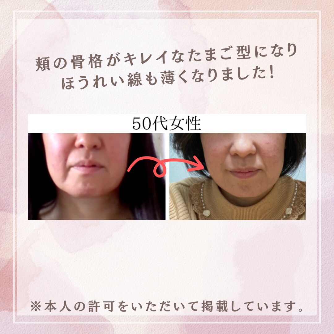 一生使える！セルフ美顔筋エクササイズを教えます 1日5分で若返り！お金をかけずにキレイになれてコスパ◎です！ イメージ4