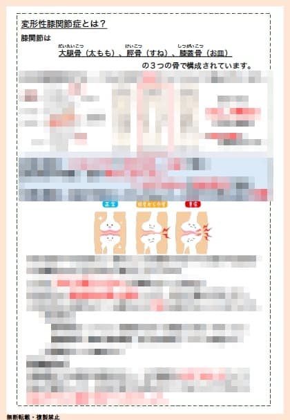 変形性膝関節症のリハビリメニューをお伝えします 変形性膝関節症の診断を受けた方の具体的な運動を！！ イメージ2