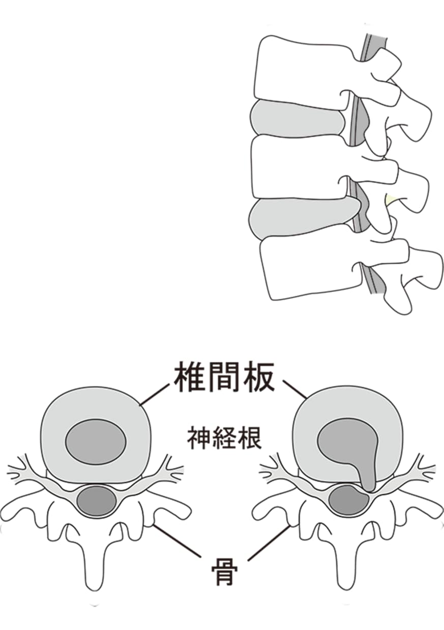 医療・福祉イラストや図をモノクロ、カラーで描きます pdf,aiファイルでの納品で、直接ご利用出来ます。 イメージ5