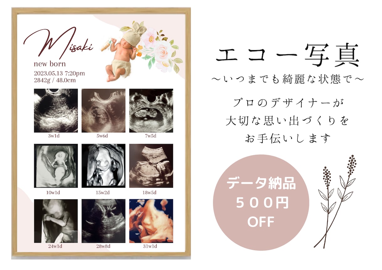 赤ちゃんの写真入りエコー写真ポスター作ります 大切な赤ちゃんの思い出をおしゃれに残しませんか？ イメージ3