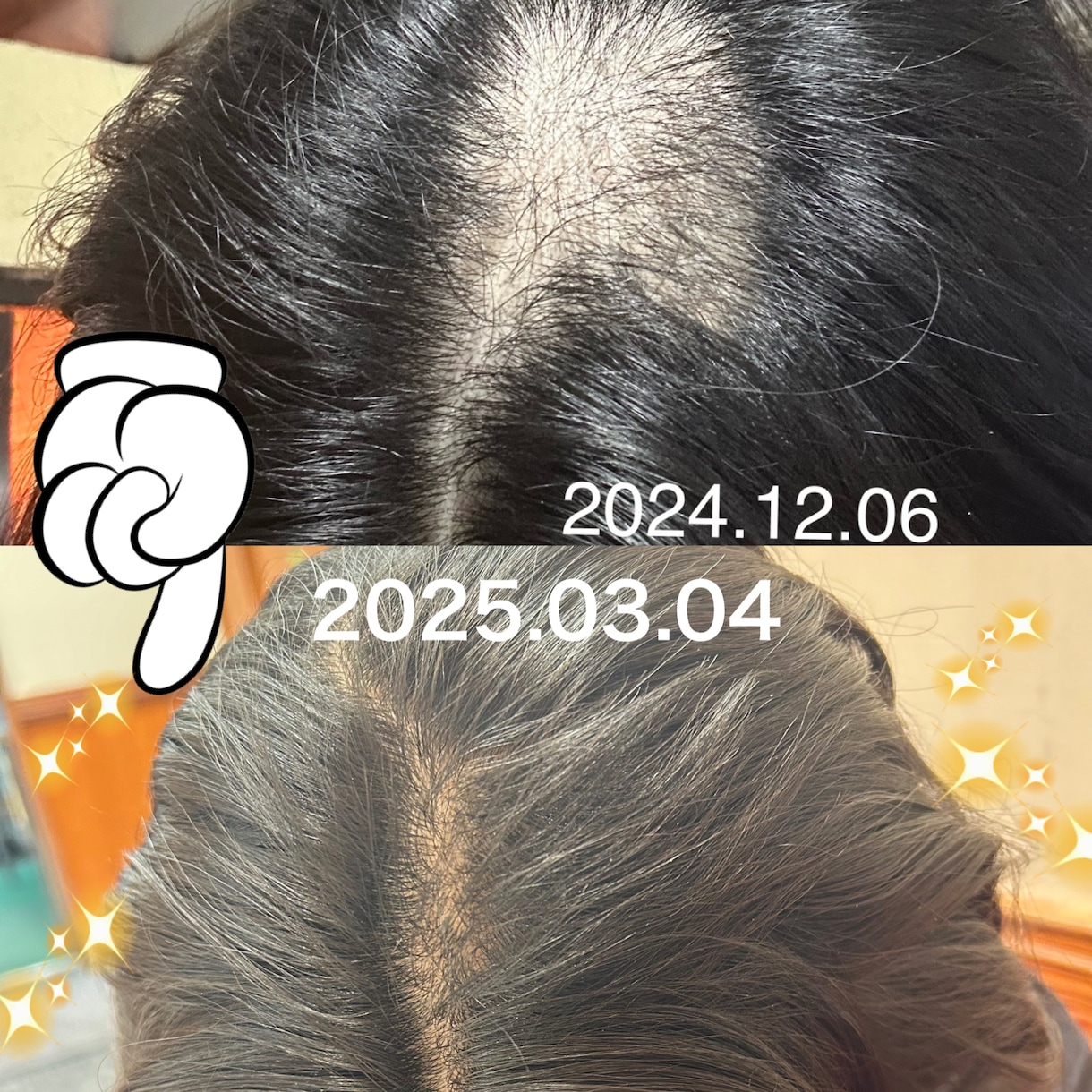 抜毛症専門！あなたの苦しみに寄り添います 私の経験談を詳しくお話します。 イメージ1