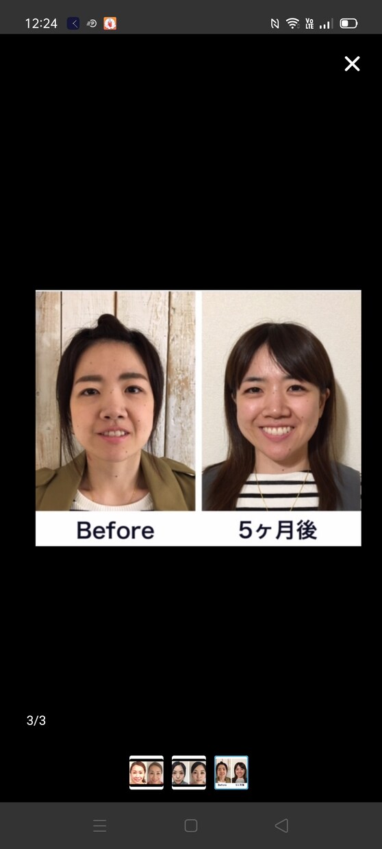 顔ヨガであなたを素敵な笑顔にします 婚活、結婚式、就活、アンチエイジングなどにおすすめ体験60分 イメージ3