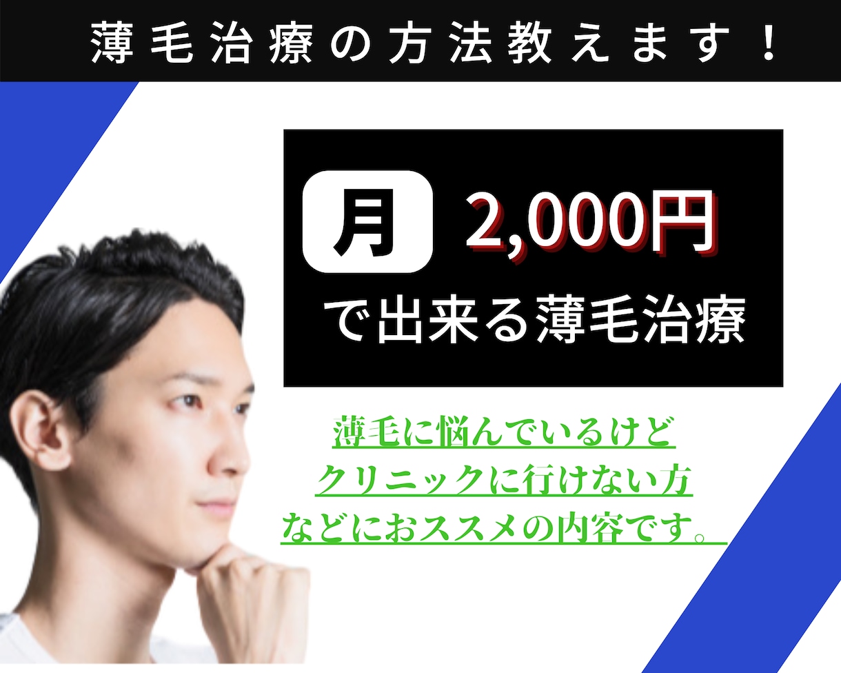大手発毛クリニックはまだ止めて！薄毛治療法教えます 〜大手発毛クリニックはこの格安薄毛治療法を試してから〜 イメージ1