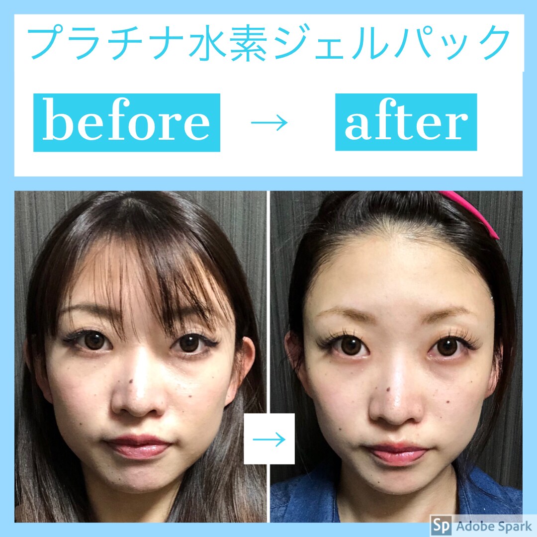 お肌のお悩みを解決します 30分後は5年前の生まれたての素肌に イメージ1