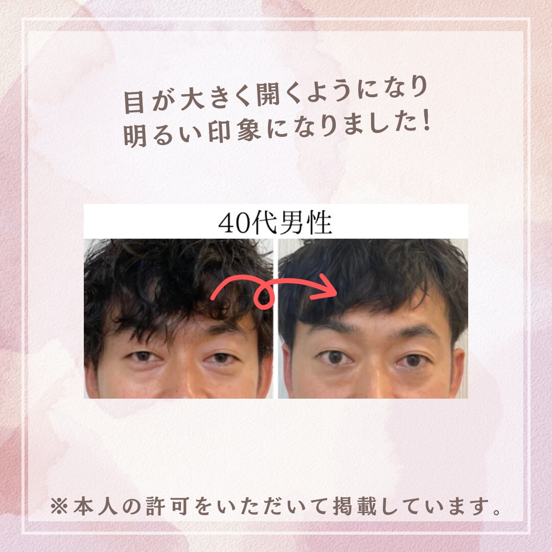一生使える！セルフ美顔筋エクササイズを教えます 1日5分で若返り！お金をかけずにキレイになれてコスパ◎です！ イメージ5