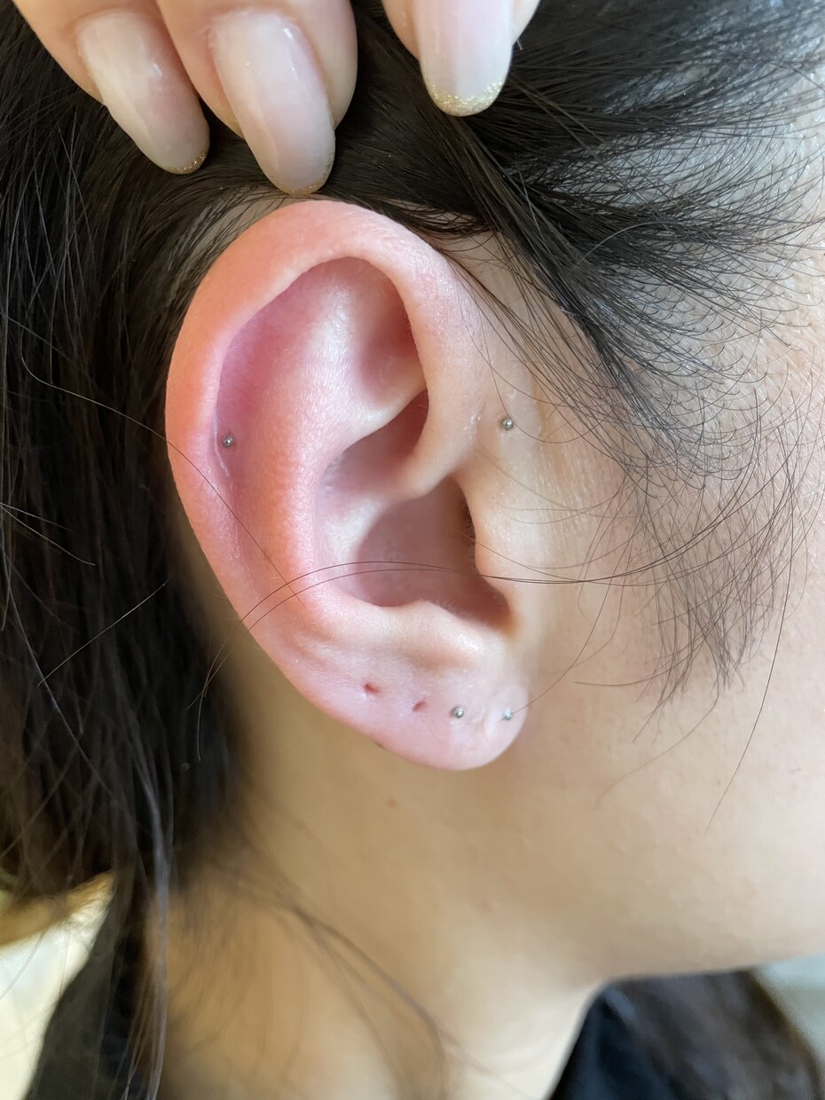 耳ツボ　体の不調な部分のツボお教えします 耳ツボセラピストです♪不調を改善しましょう。 イメージ2