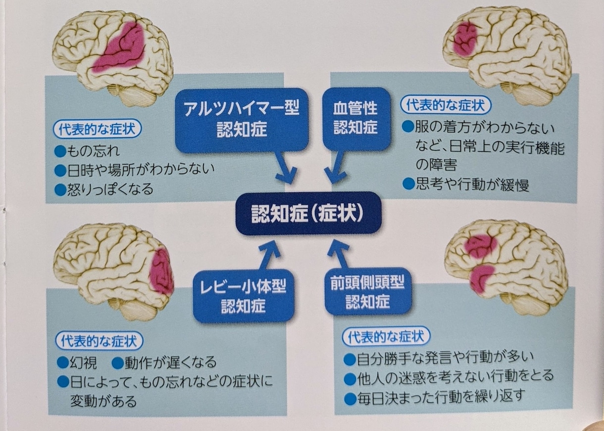 認知症かも？と思った時の対応のポイントを教えます 大切な方の早期の認知症の症状に関する不安や疑問にお答えします イメージ8