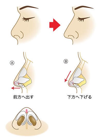 顔写真から必要な美容整形を診断・提案します 元大手美容外科カウンセラーが必要な手術やオペ内容を徹底解説！ イメージ4