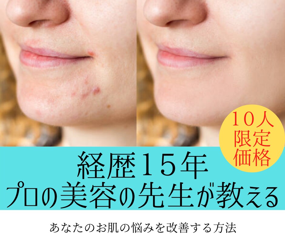 無料相談あり！肌を丈夫に美しくする方法教えます ココナラ初出品記念！美容の先生が肌トラブル改善いたします！ イメージ1