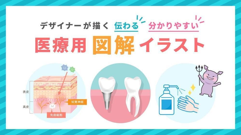 分かりやすい！伝わる！図解・解説イラスト制作します 整形外科・歯科・美容外科様など様々な図解イラストを作成 イメージ2