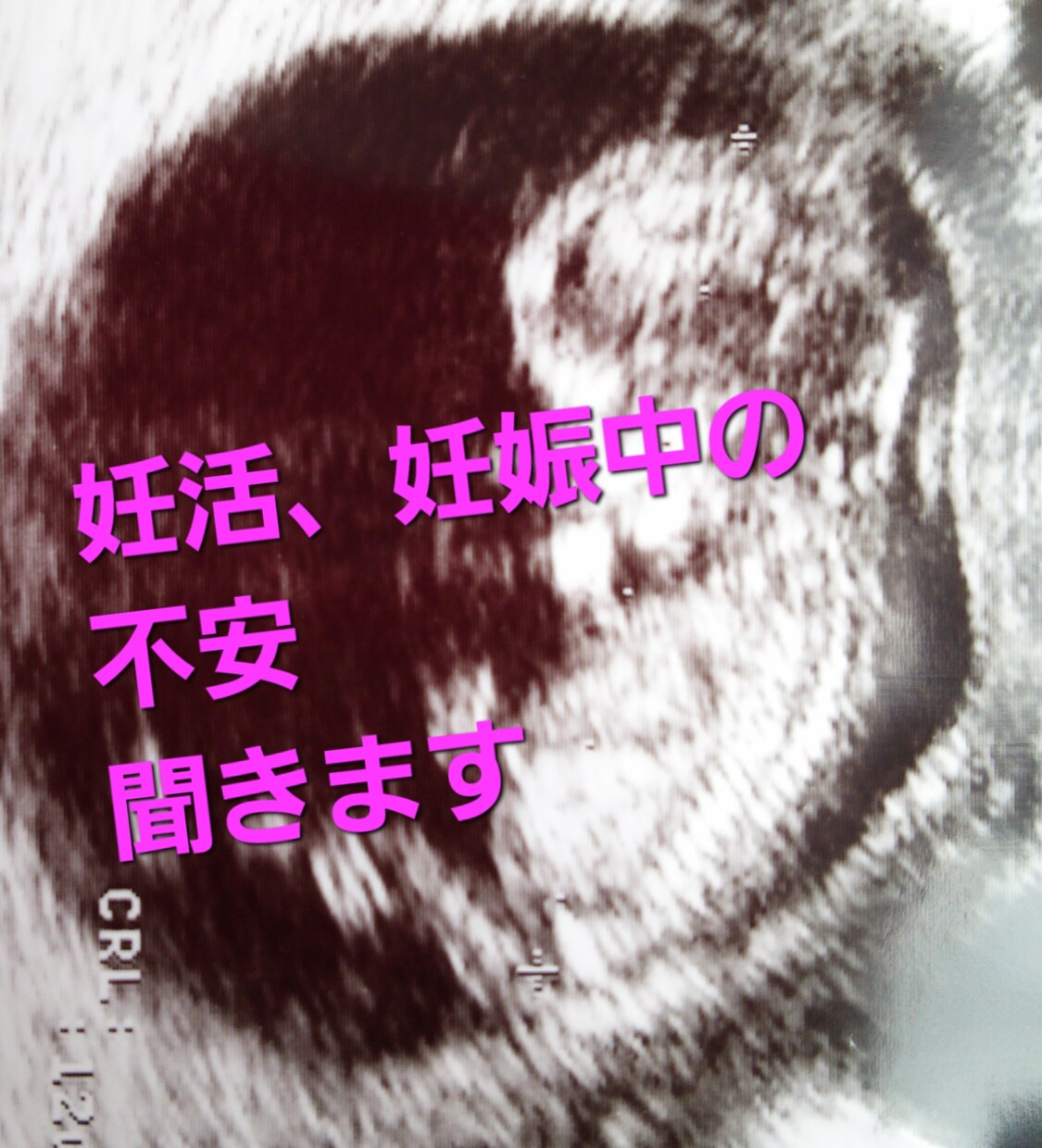 妊活、妊娠、流産、出産のお悩みを聞きます 妊娠中、私も毎日物凄く不安でした。だからこそお力になりたい イメージ1