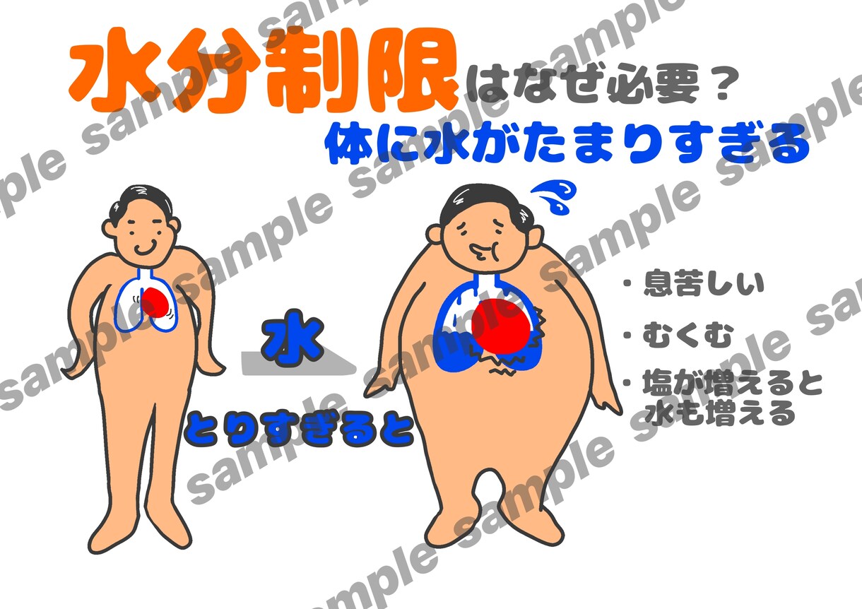 透析患説明がラクになる図解４枚セット作成します ３秒で伝わる！患者説明を楽にする図解 イメージ4