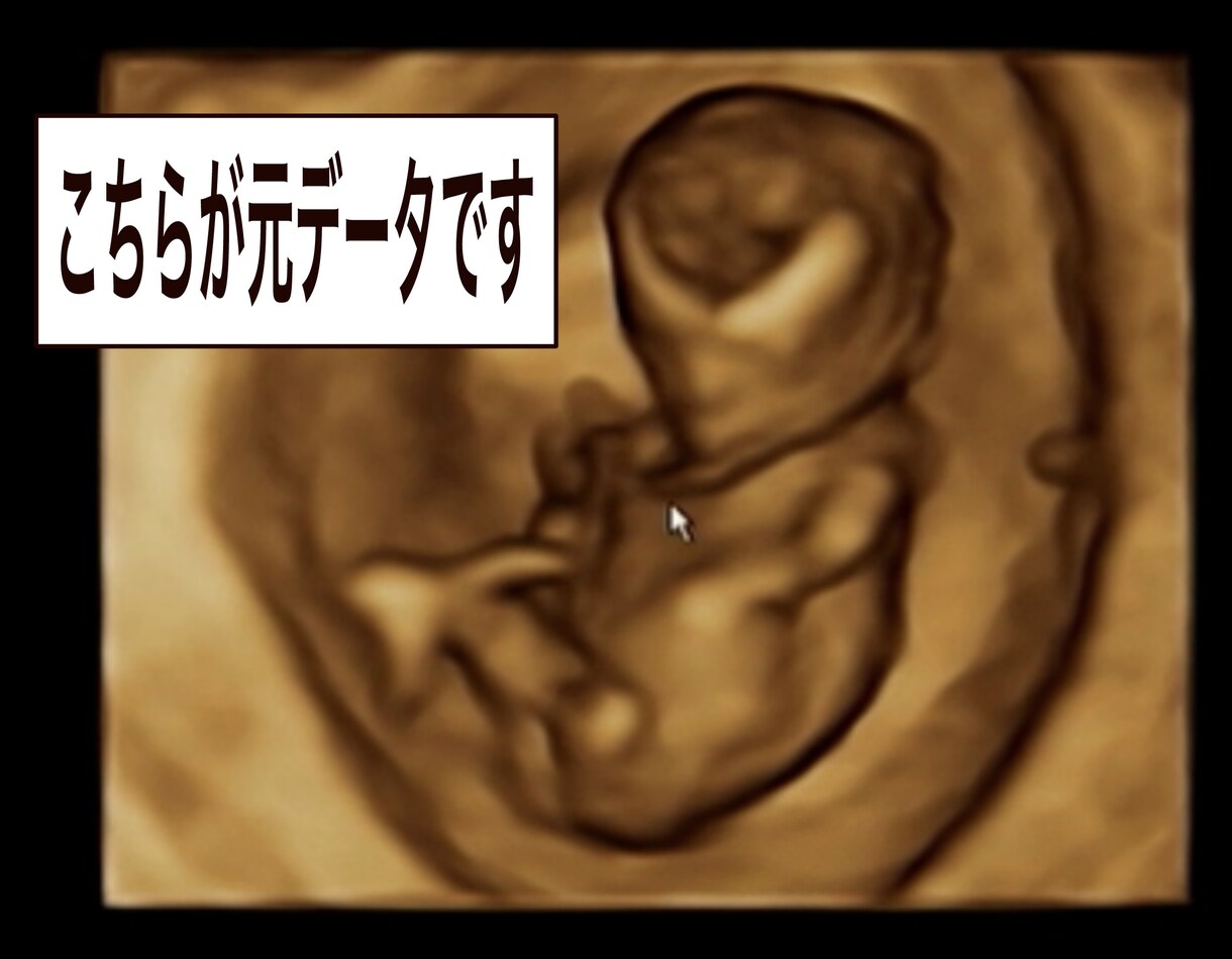 4Dエコーを自然に可愛く修正orイラスト化します 産婦人科専門医が4Dエコーをわかりやすく修正します。 イメージ2