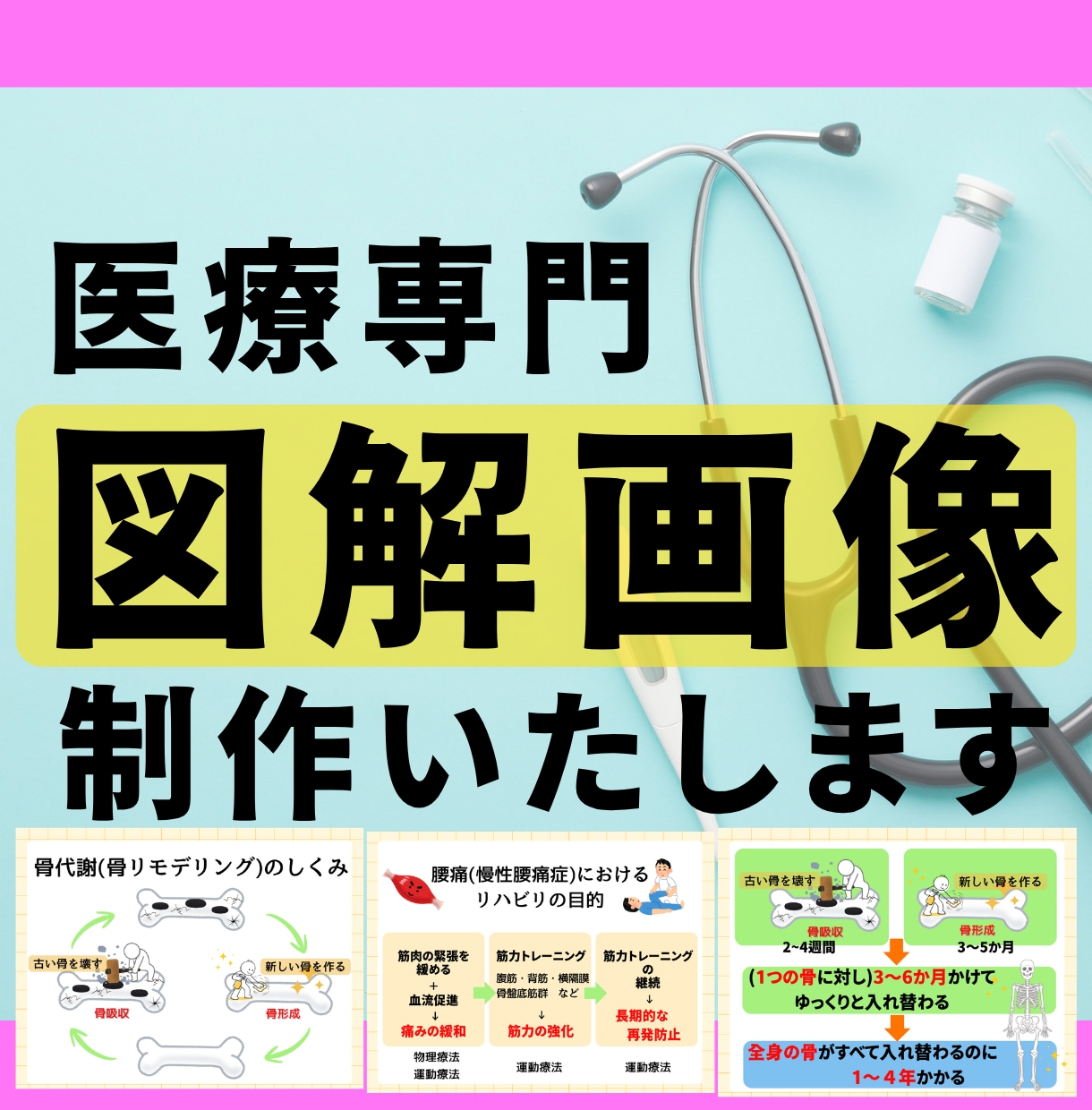 医療の専門性を優しく伝える図解画像を制作します 患者さんにも伝わりやすい安心感ある図解画像を制作いたします。 イメージ1