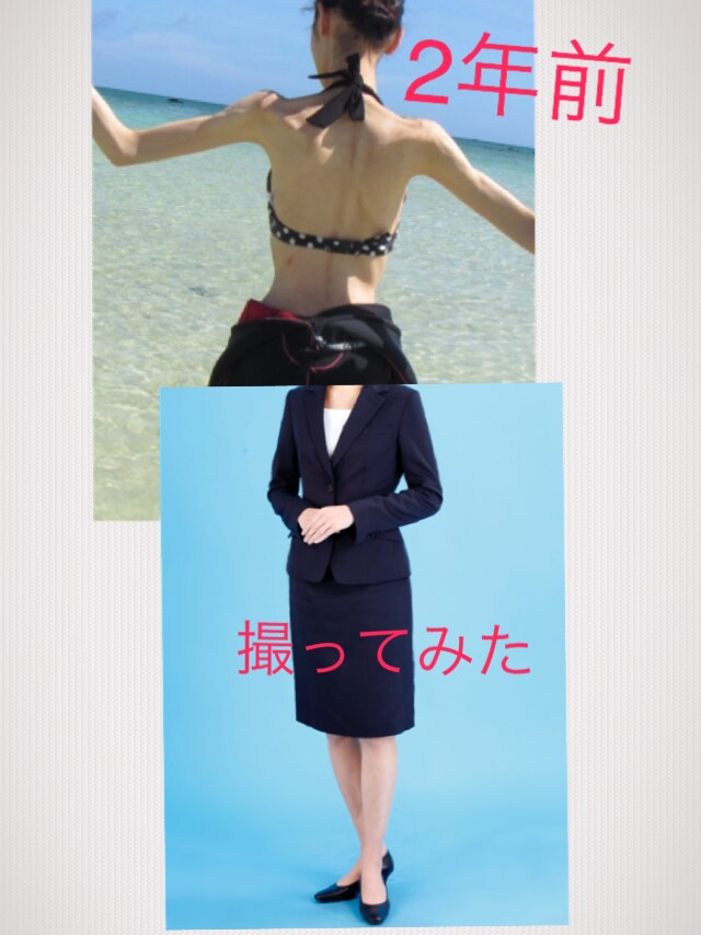 拒食症共に克服します 自分で拒食症を克服し幸せを見出した経験者カウンセラー！ イメージ1