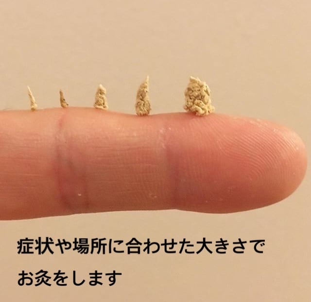 意外と知られていないお灸の使い方教えます 小さなお子様から大人まで日々が快適に過ごせるお灸の使い方 イメージ1