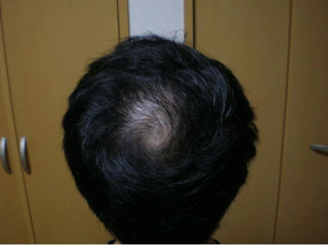 髪を習慣だけで全力で蘇らせます 髪は大切な体の一部です。髪の悩みを解消し充実した人生へ！ イメージ3
