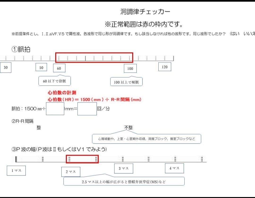 洞調律チェッカーを提供します 心電図をみるのが楽しくなる！洞調律チェッカーです。 イメージ2