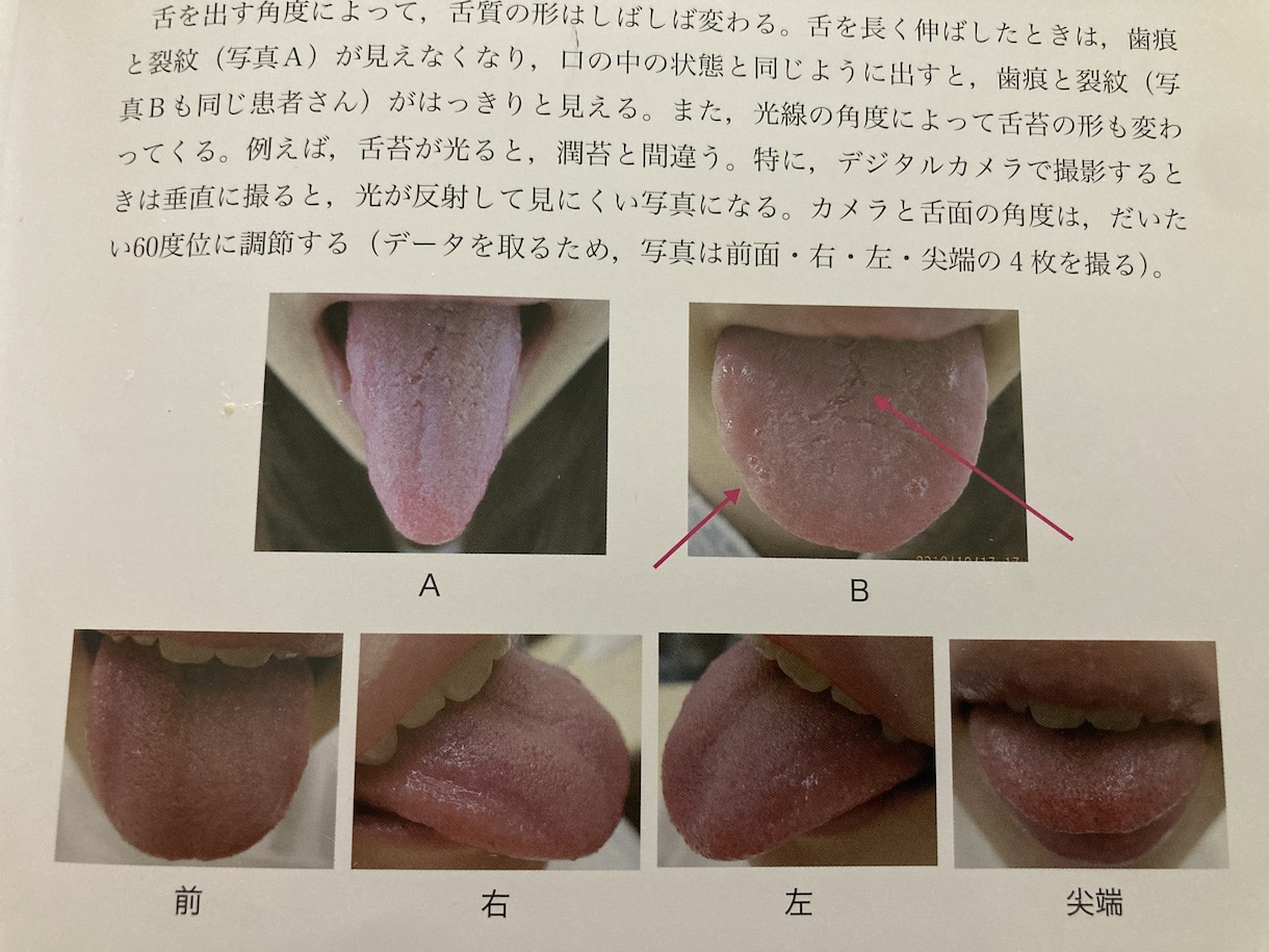 心身が発する警告を漢方薬剤師が舌相占い?を致します あなたに必要な食べ物や過ごし方をあなたに寄り添い案内します。 イメージ2