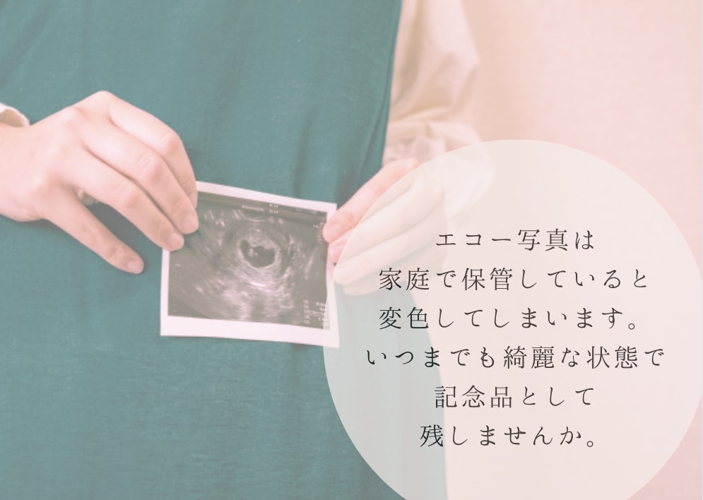 赤ちゃんの写真入りエコー写真ポスター作ります 大切な赤ちゃんの思い出をおしゃれに残しませんか？ イメージ5