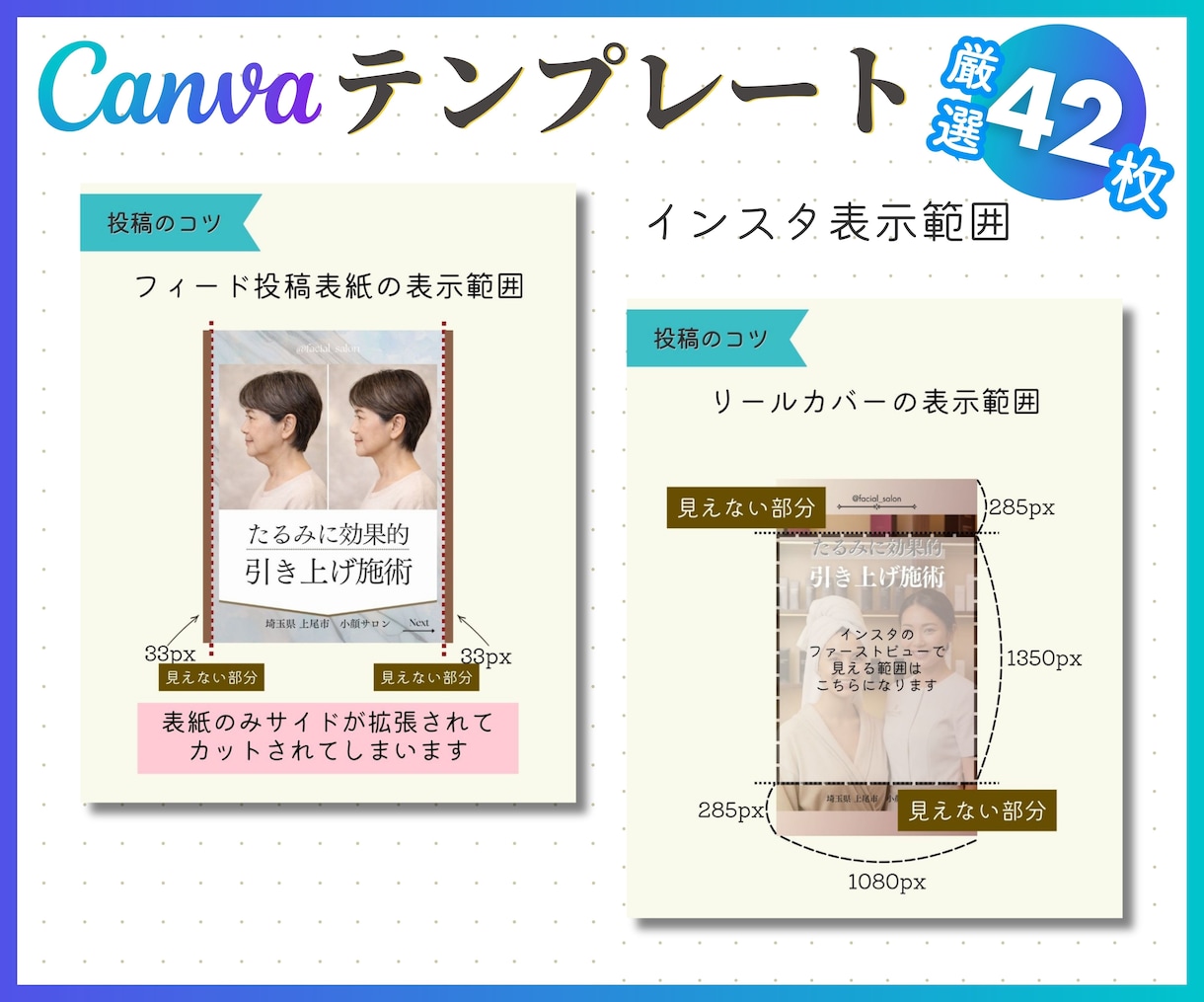 エステサロン専用・インスタテンプレート販売します 時短でプロ級の仕上がり！自由自在に変更してフィード投稿制作！ イメージ9