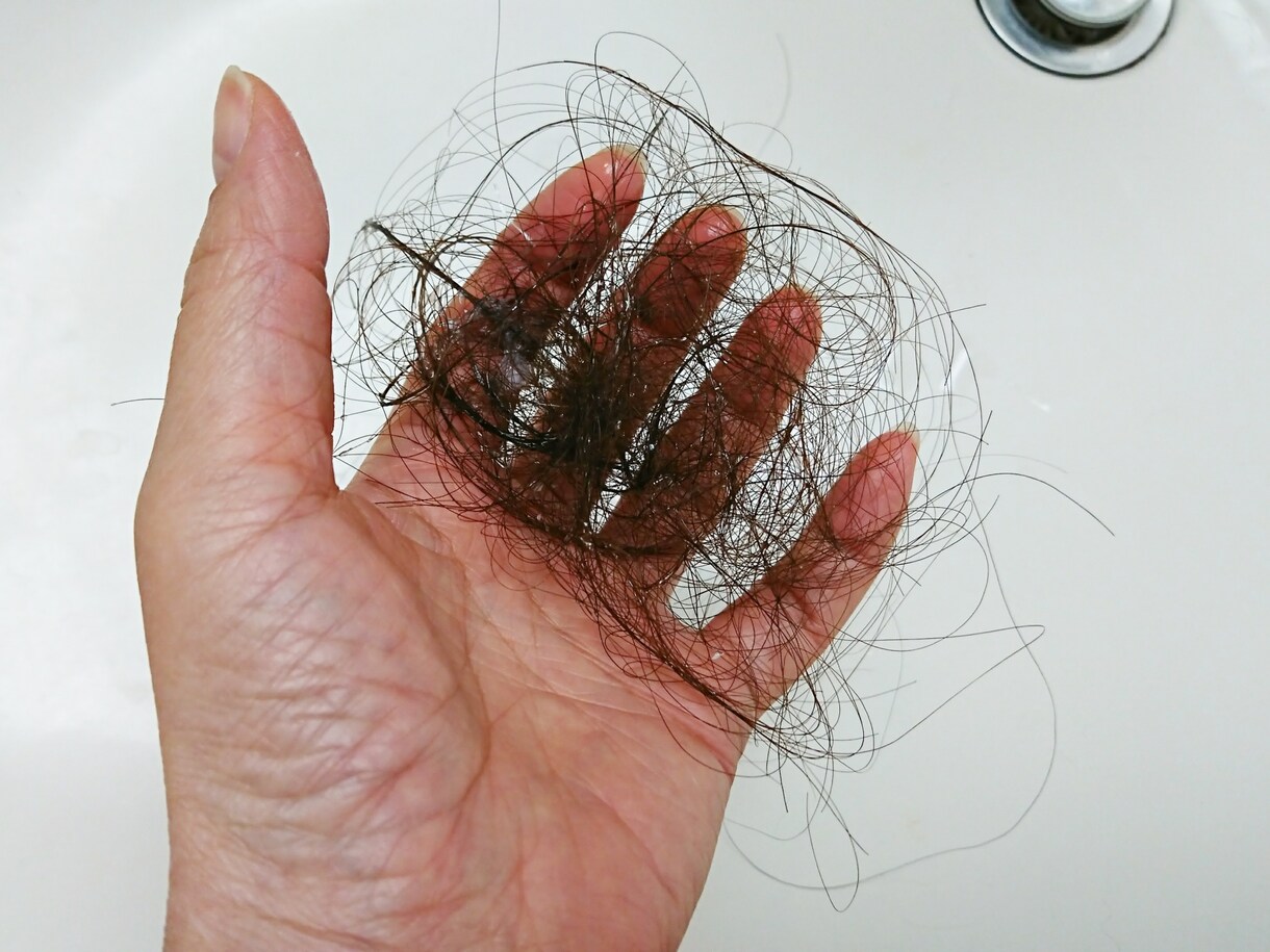 頭皮のカウンセリングの達人があなたの相談に乗ります ３０年の実績！抜け毛・薄毛・頭皮でお悩みの方お気軽に相談を！ イメージ4