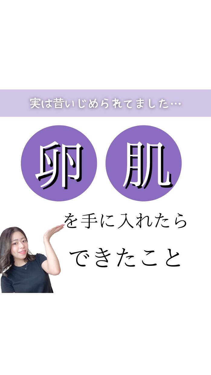 ニキビ改善のためのスキンケアプログラム教えます あなたの為のオリジナルスキンケアプログラム！ イメージ1