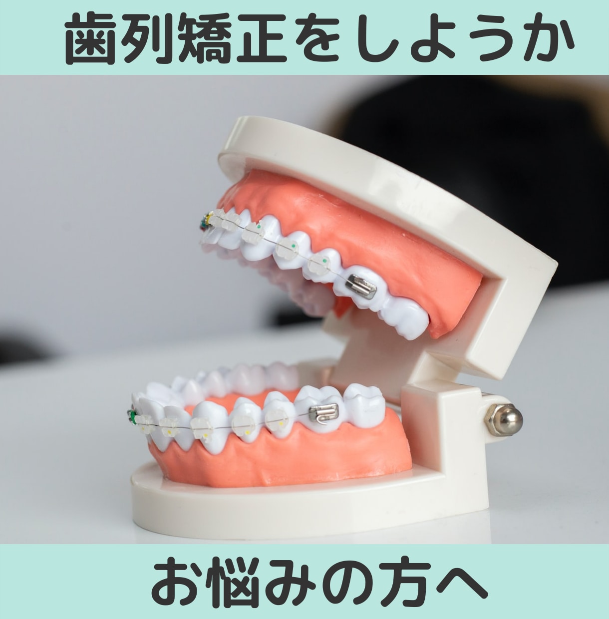 経験者の立場から歯列矯正の不安・悩みに相談のります これから歯列矯正をしようか迷っている人へ イメージ1