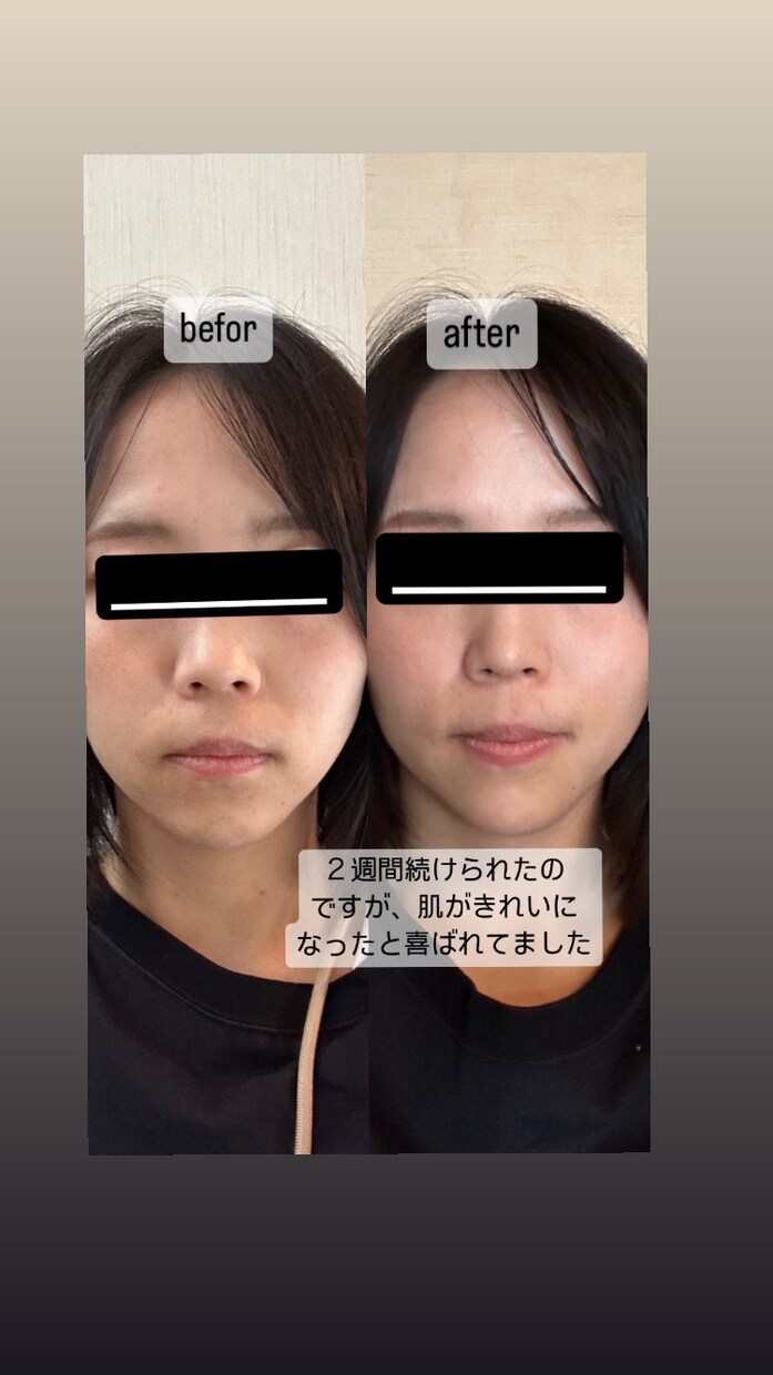 顔ヨガで小顔、リフトアップになる方法を教えます １００名以上の実績あり、効果を感じて頂いています イメージ7