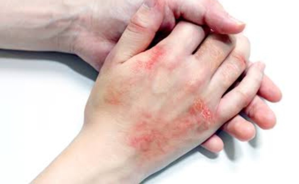 肌荒れの相談のります 試行錯誤を繰り返した私の皮膚科要らず治療法伝授！ イメージ1