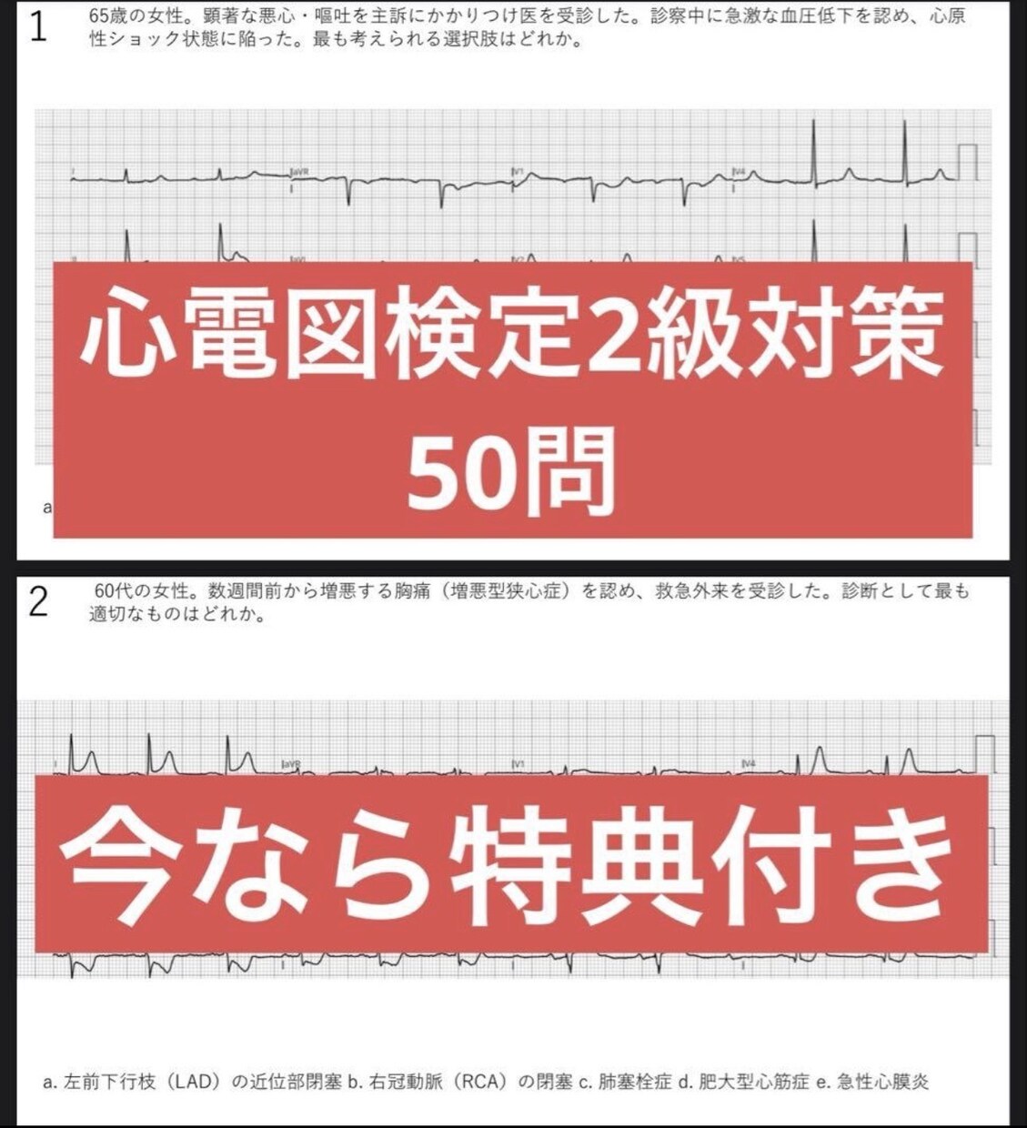 心電図検定2級資格取得サポートをします 心電図検定1級取得者が資格取得サポートをします！ イメージ2
