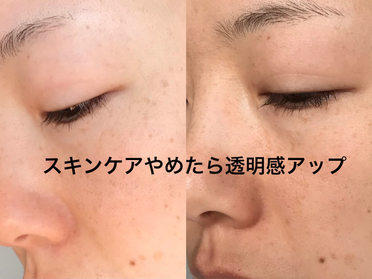 軽くするほど美肌になる、スキンケアの引き算教えます 乾燥、くすみ、たるみ、毛穴は年齢のせいじゃない イメージ1